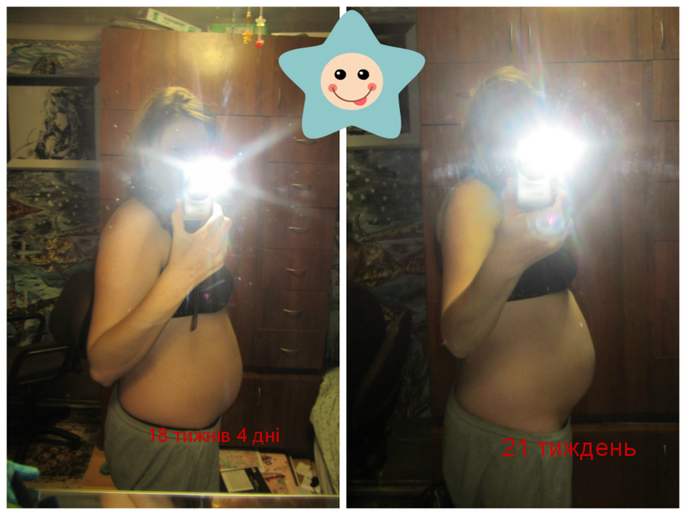 21 неделя ровно)