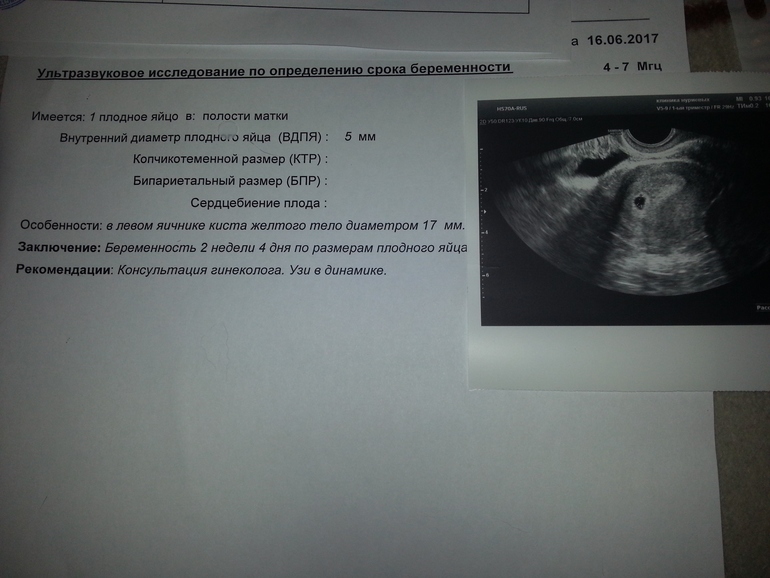 Консультант тула узи беременных 11