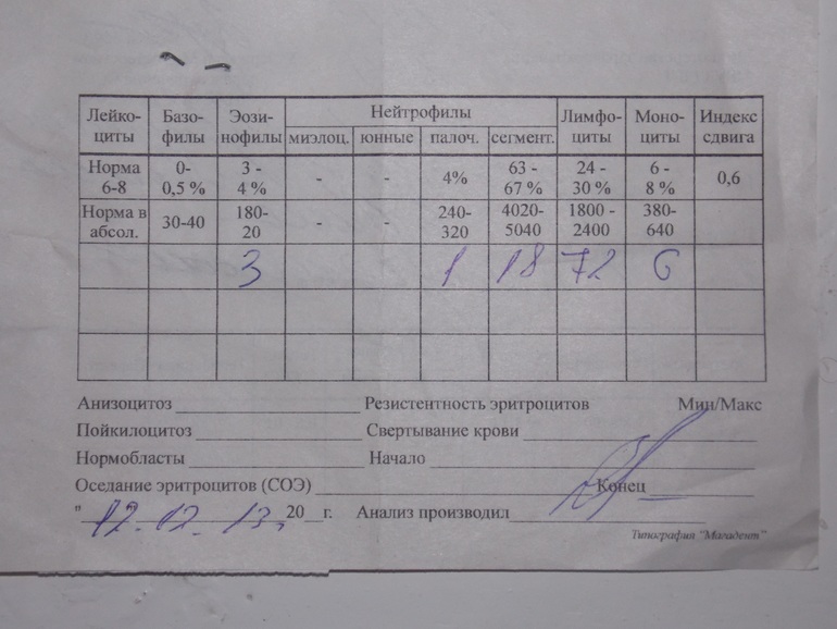 Анализ крови.