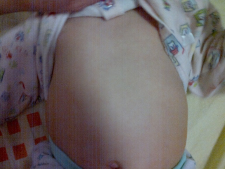 нормальное ли строение грудной клетки у моего ребенка