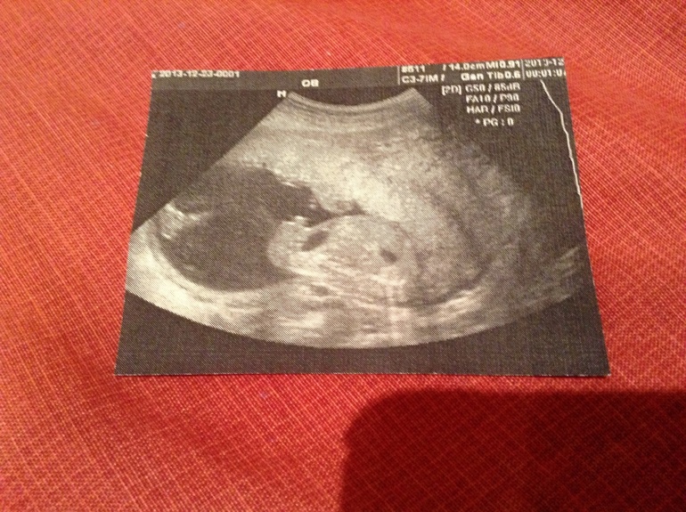 Точно мальчик?:)