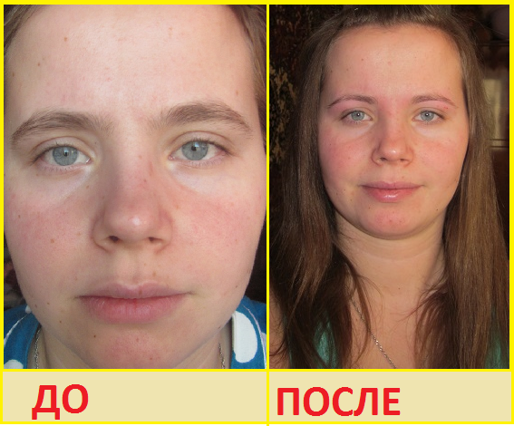 ДО - ПОСЛЕ.
