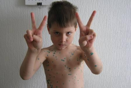 Леопёрдик