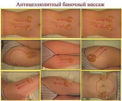 День 7. Целлюлит и борьба с ним
