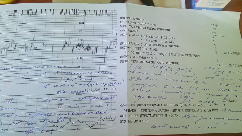 Результаты УЗИ и КТГ.36 неделя по ББ