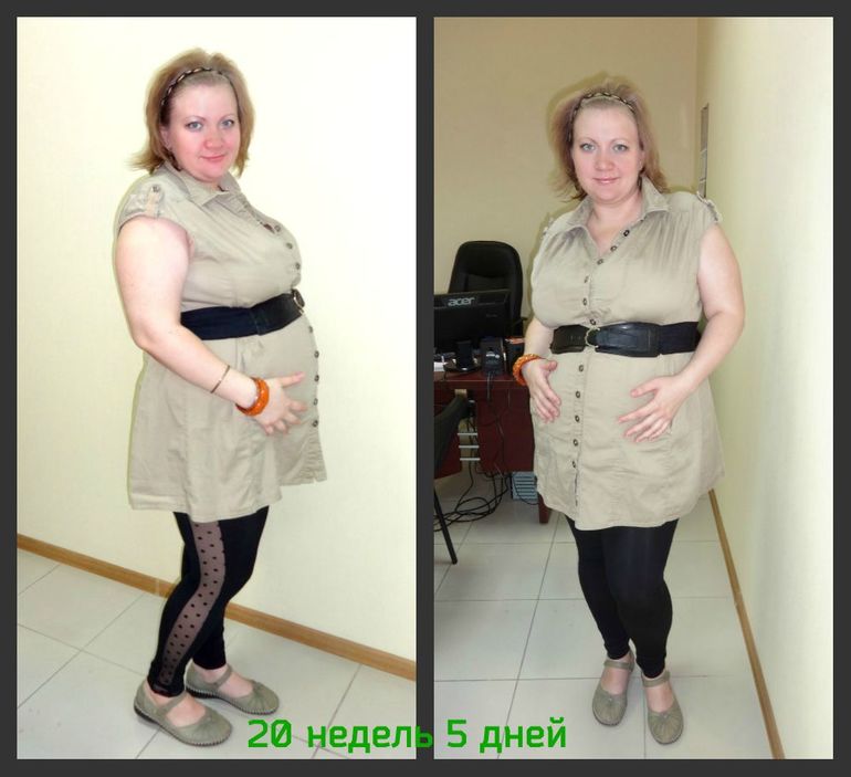 21 неделя )