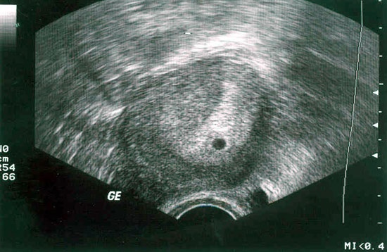 девочки,нужна ваша помощь!)))