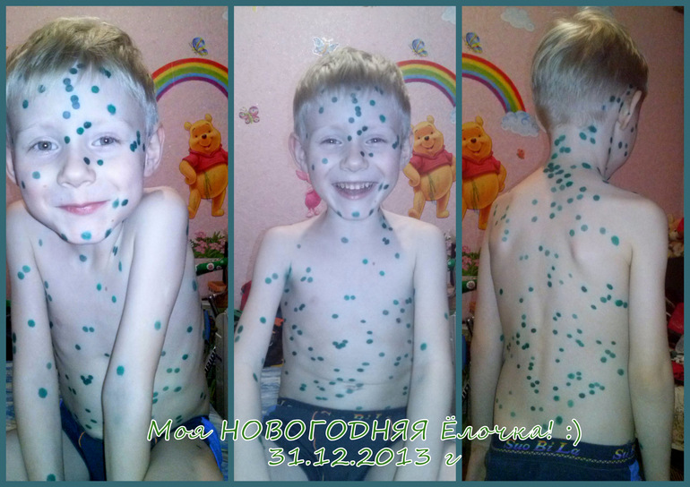 Ветрянка ))) новогодняя )))