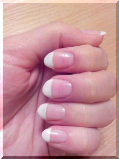 Рост ногтей