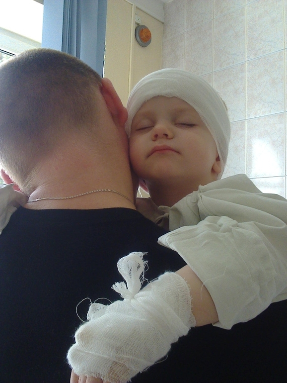 Кохлеарная имплантация г. Минск 2014г.