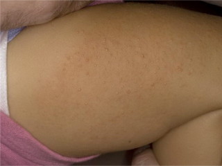 Действительно ли АД?