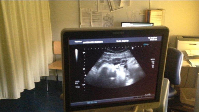 наши портретные Узи в конце 38-ой недели