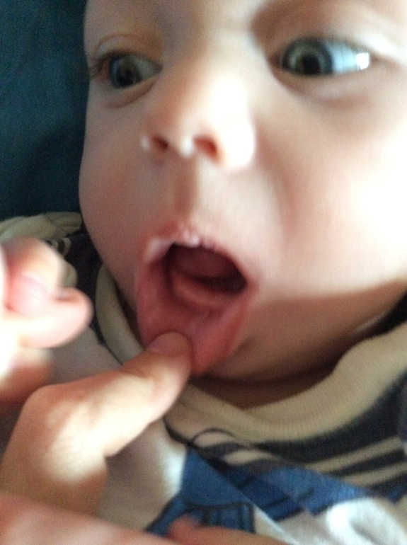 Зубы или нет?