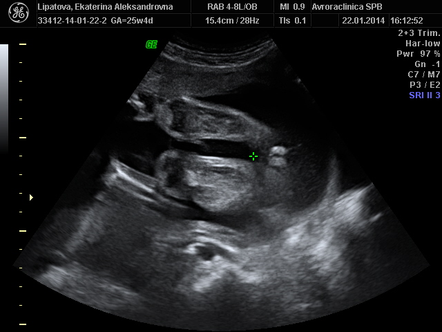 как это я да не буду сомневаться?)))