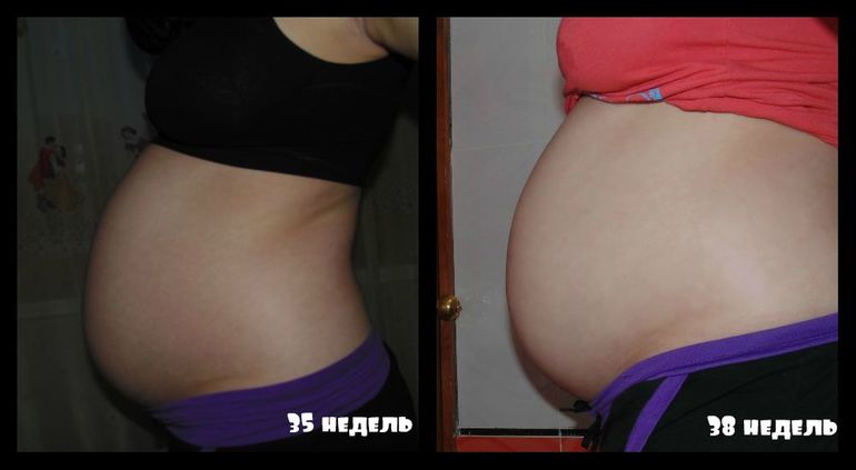 39 неделька+фото