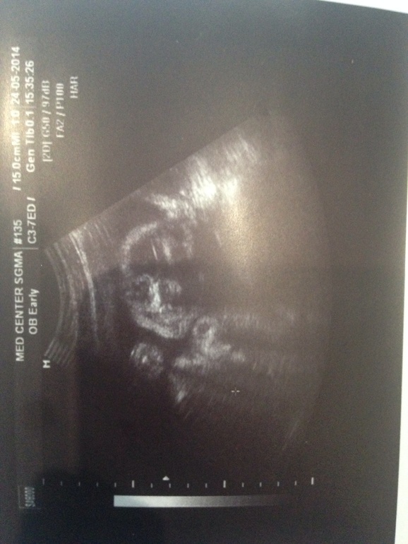 Наши 25 неделек + 4 дня + фото подкат