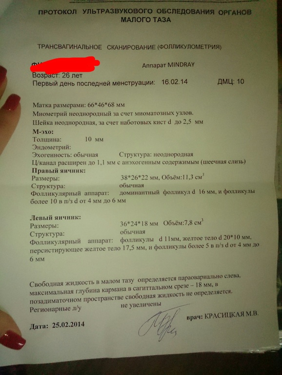 Опять я с вопросом...