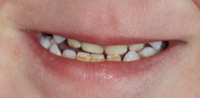 Налет или нет?