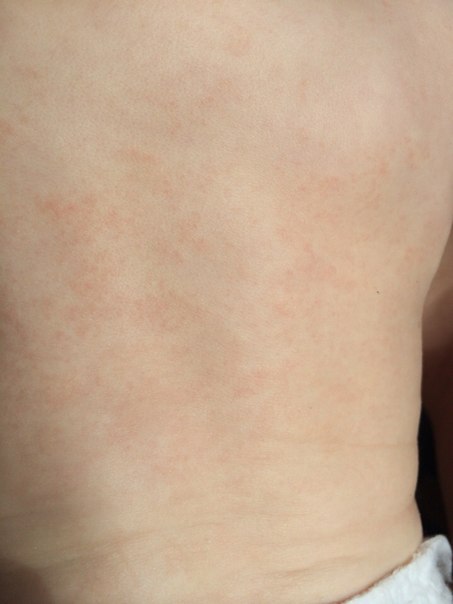 Девочки помогите...сил нет