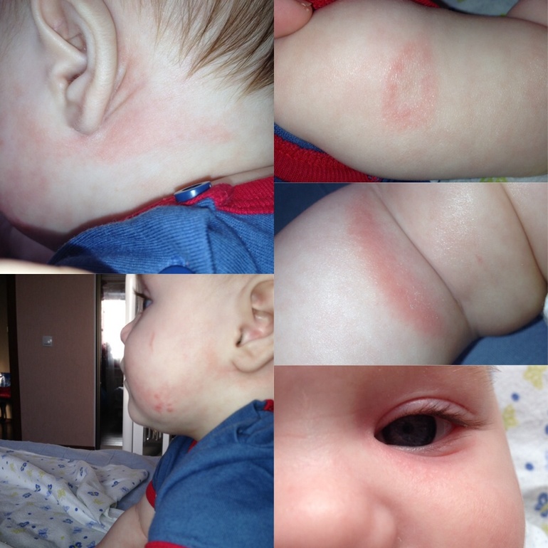 Неокейт день 11