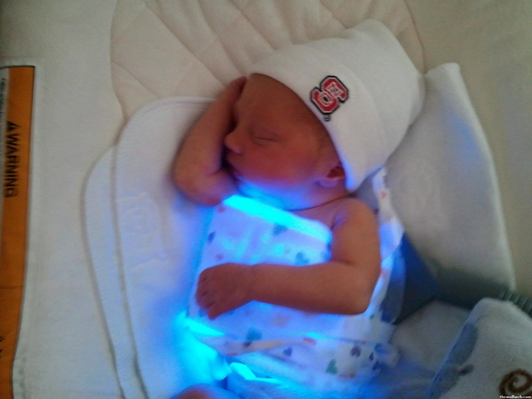 Желтуха,опасно ли это? Лечение в домашних условиях,вы родили в США