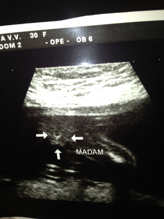 Не умеем мы делать мальчиков!