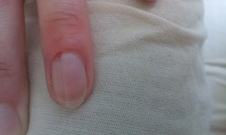 Что это может быть??