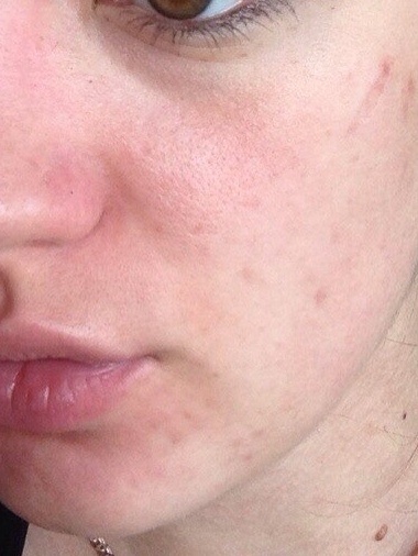 Какие крема самые эффективные?