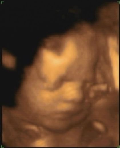 30-я неделя началась с УЗИ крохи