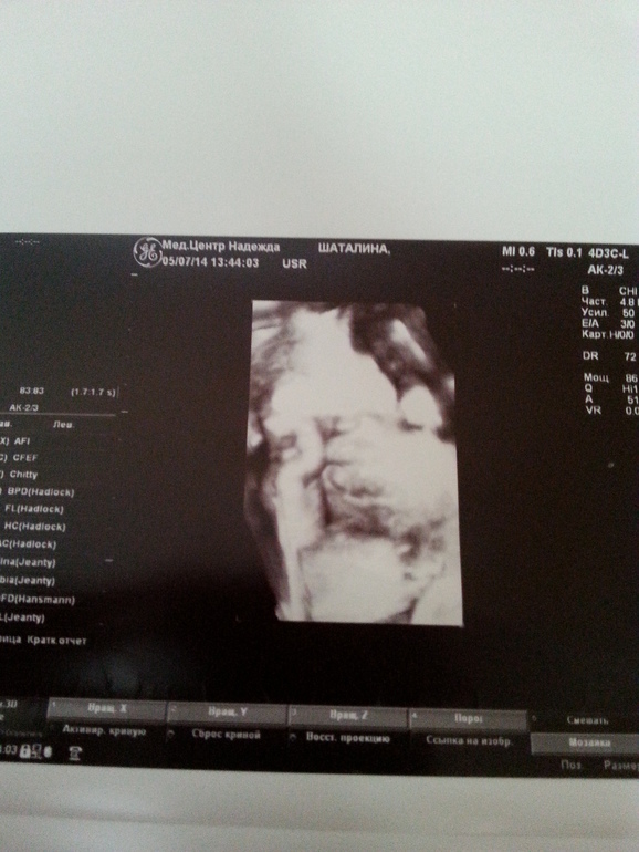 32 недельки)))