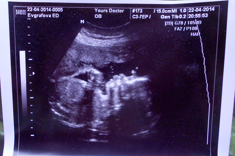 Сомнения продолжаются