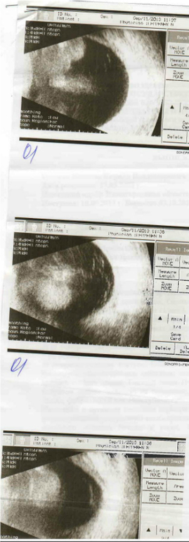 Обследование.