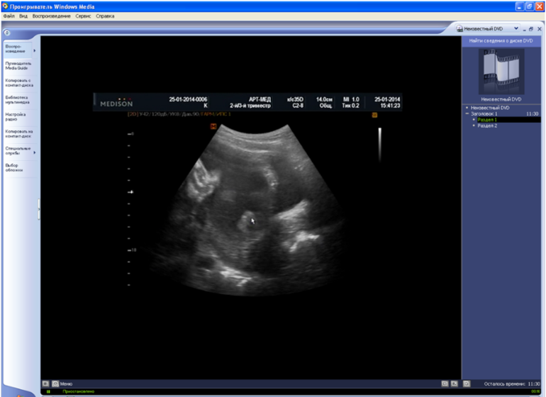 помогите определится с полом