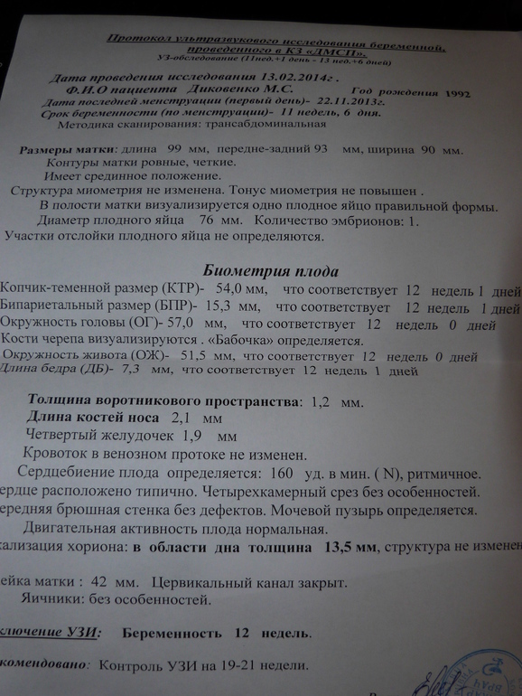 Моё Узи)