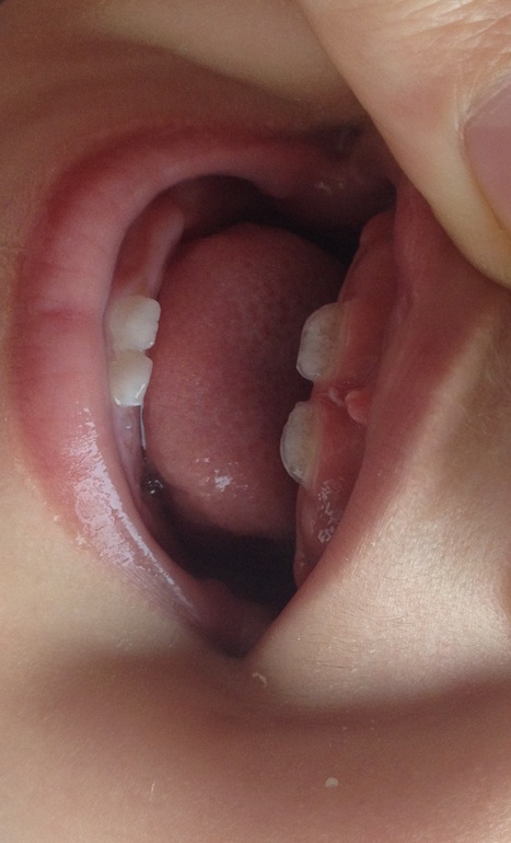 Потемнение