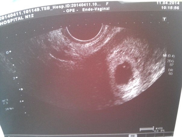 Девочки, помогите разобраться((((