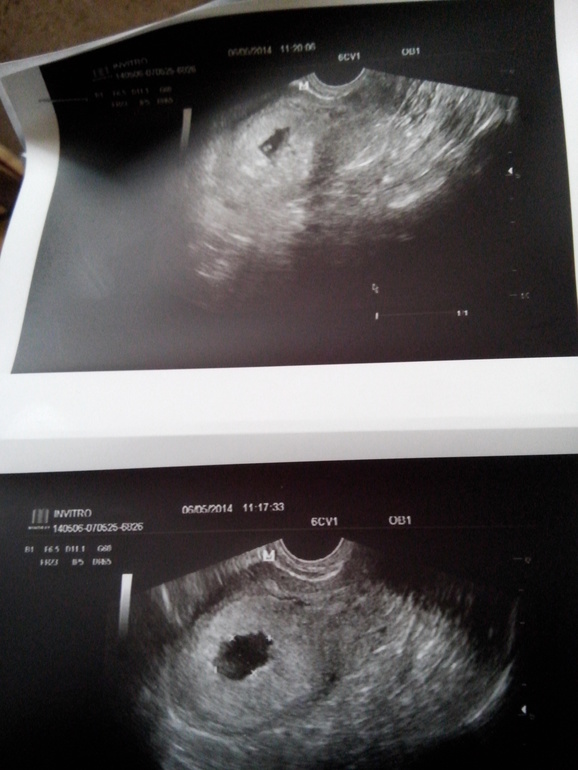 Девочки, помогите разобраться((((