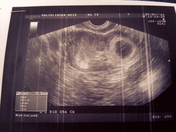 Девочки, помогите разобраться((((