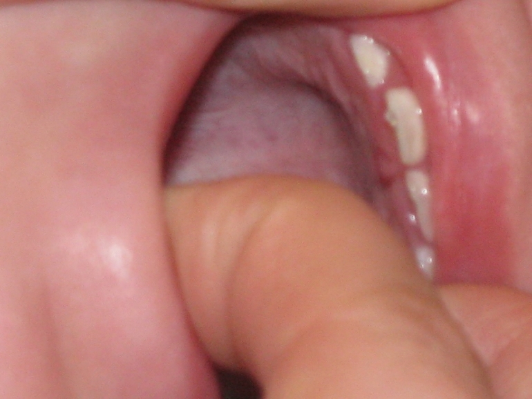 Что с зубами?