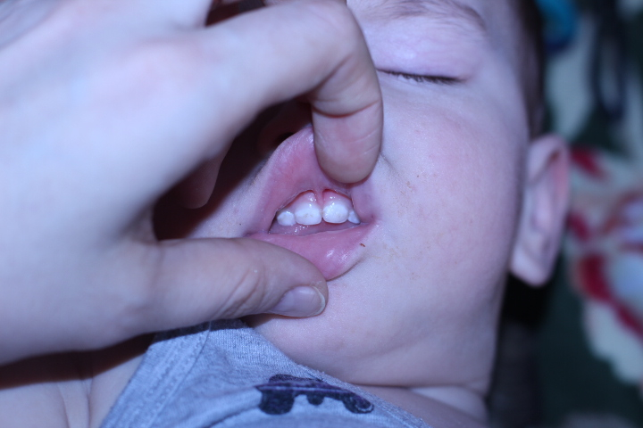 первые проблемы