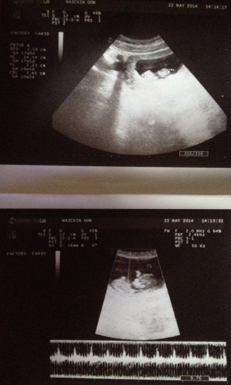 Сходили с мужем на УЗИ :)