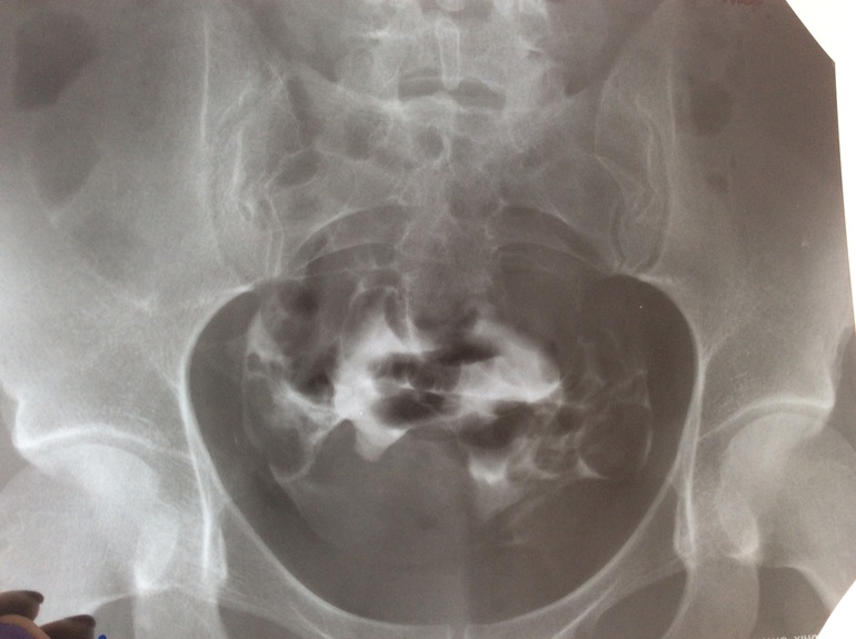 Результаты ГСГ