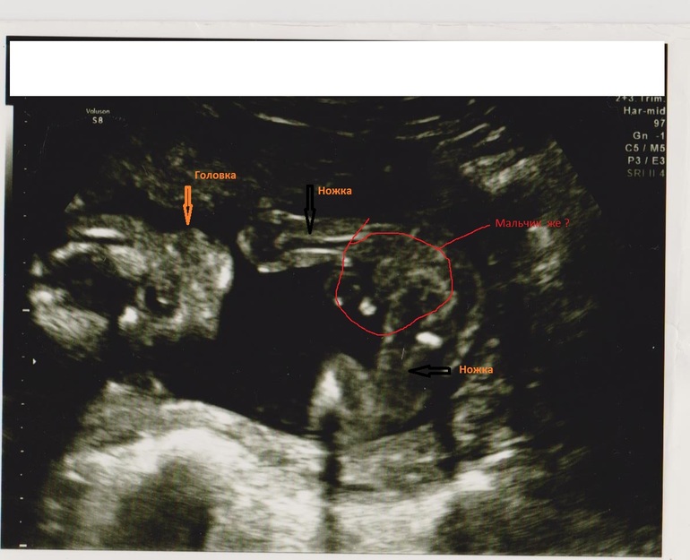 Пол МАЛЫША :)