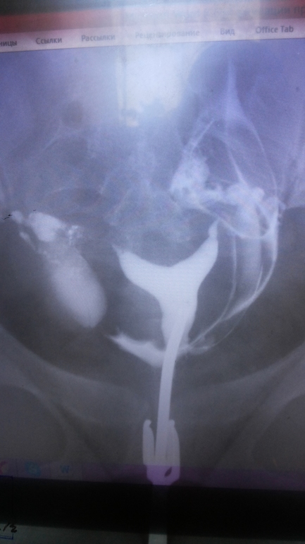 девочки может кто понимает????