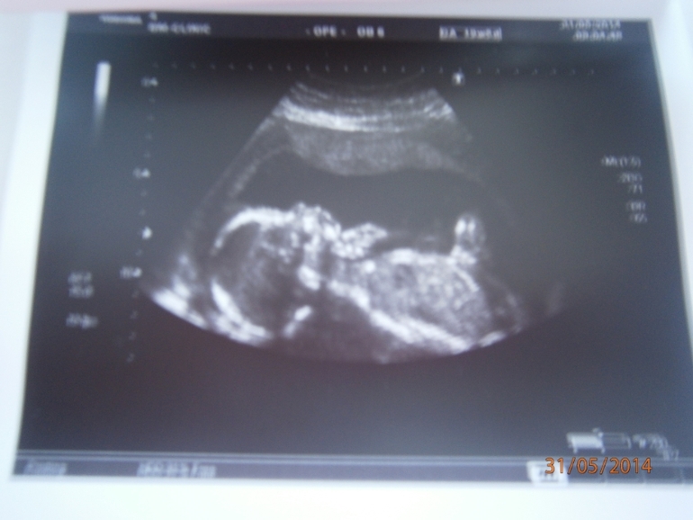 Наше долгожданное УЗИ и пол!!!!!