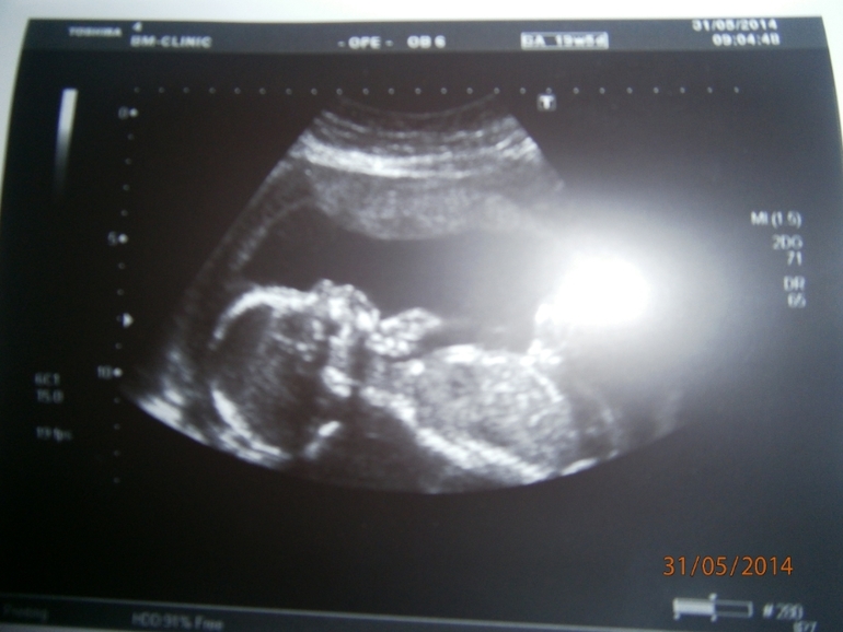 Наше долгожданное УЗИ и пол!!!!!