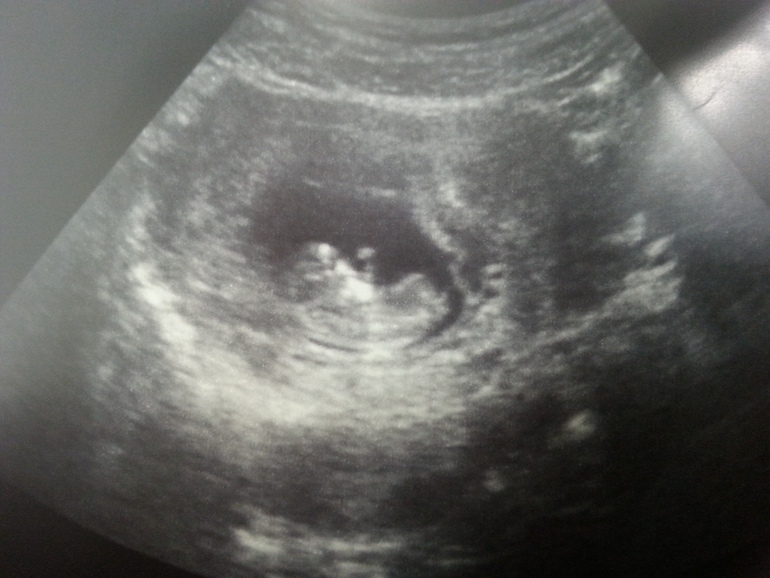 А вот и МЫ!!!