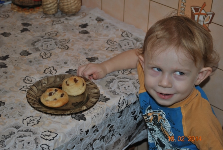 Мешки под глазами, врач сказала норма..