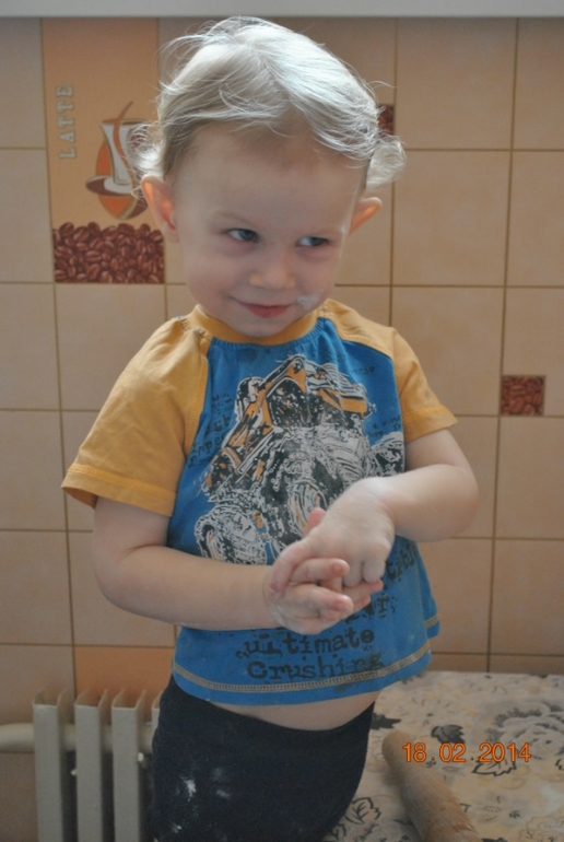 Мешки под глазами, врач сказала норма..