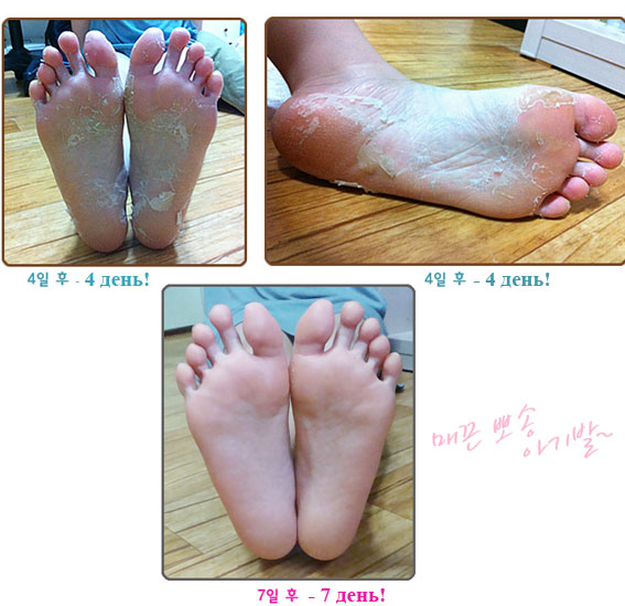 Заказываем!!! Пилинг для ног от Holika Holika